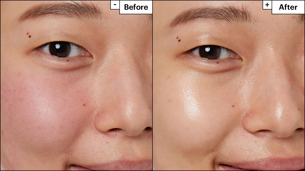 Before and after results reveal moisturized, glowing and hydrated looking skin with less visible redness